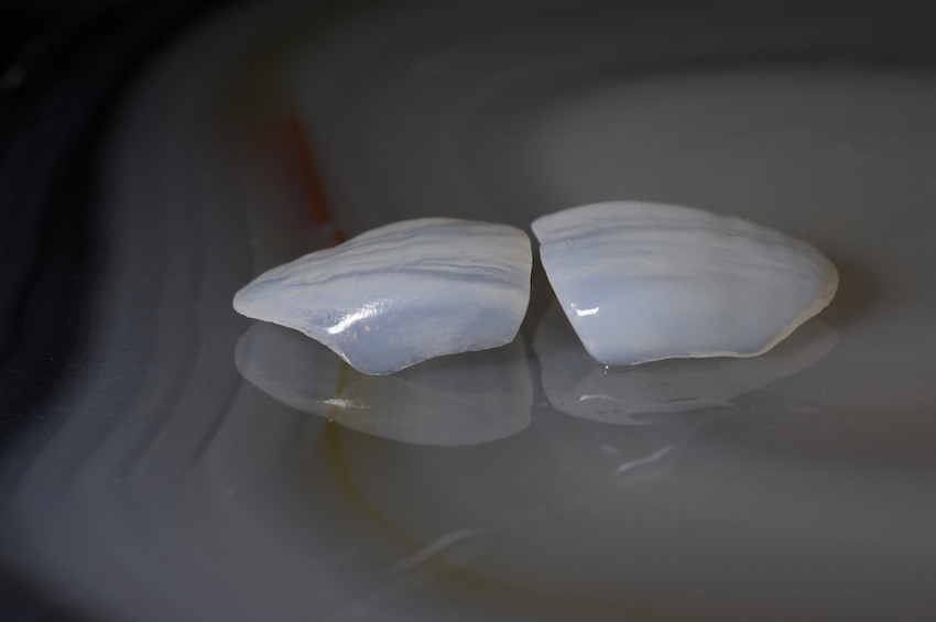 Meisterliche zahntechnische Arbeit vom Dentallabor Goebel
